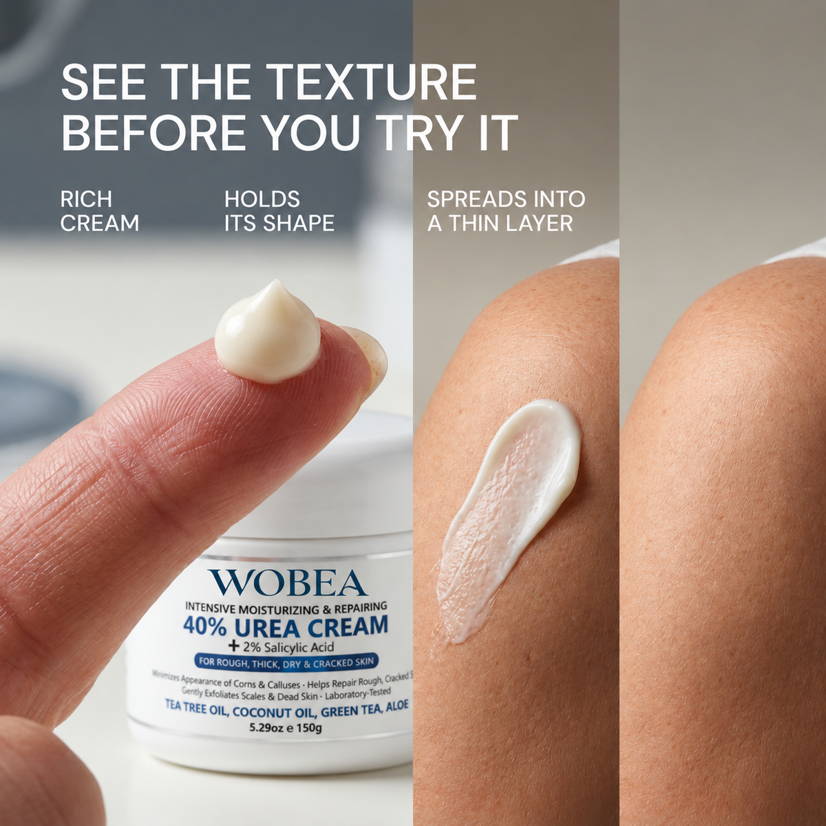 SK Renewal 40 — Advanced Keratolytic Cream For Rough, Raised Seborrheic Keratoses